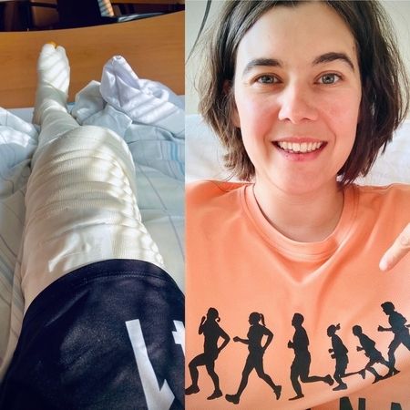 Portrait von ehemaliger Patientin und ihr einbandagiertes Bein