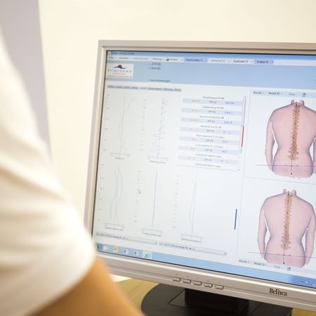 Eine 3D Wirbelsäulenanalyse wird am Computer durchgeführt