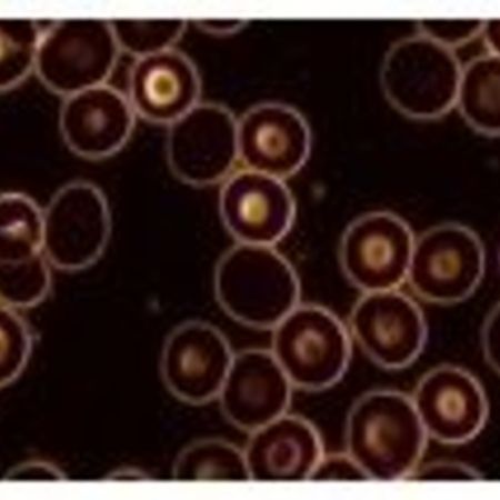 Dunkelfeldmikroskopie in der Detailaufnahme