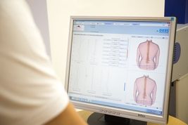 3D Wirbelsäulenscan - Analyse am Computer